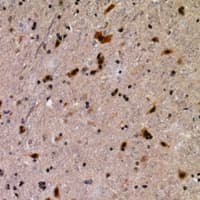 CHCHD3 Antibody
