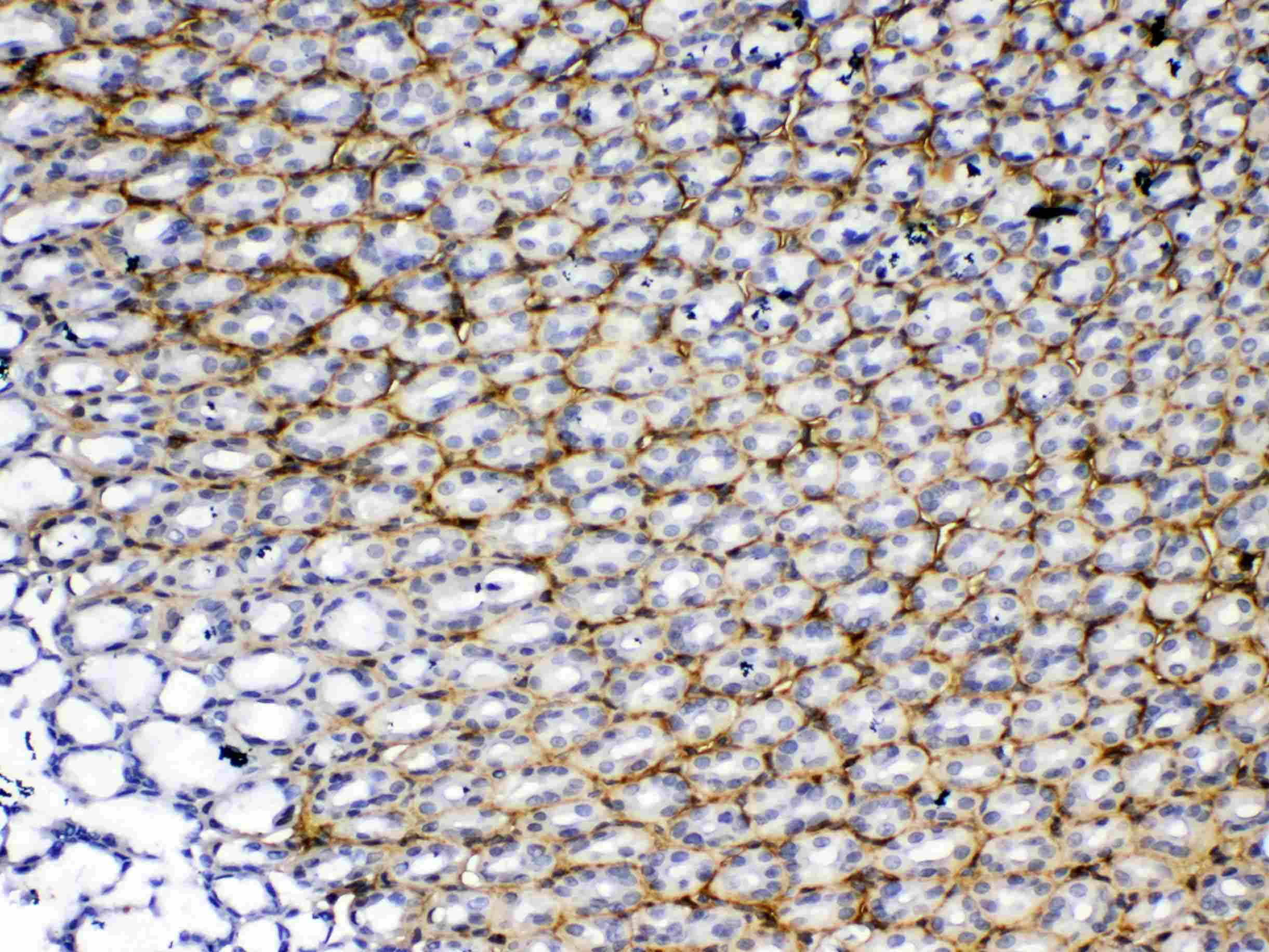 Polyclonal Rabbit anti-Rat POSTN / Periostin Antibody (IHC, WB)