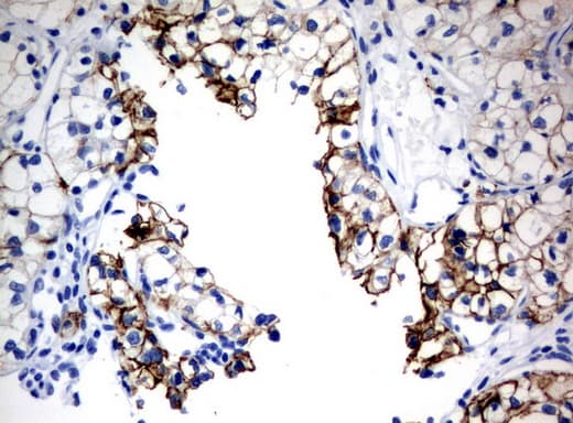CA12 / Carbonic Anhydrase XII Antibody (clone UMAB121)