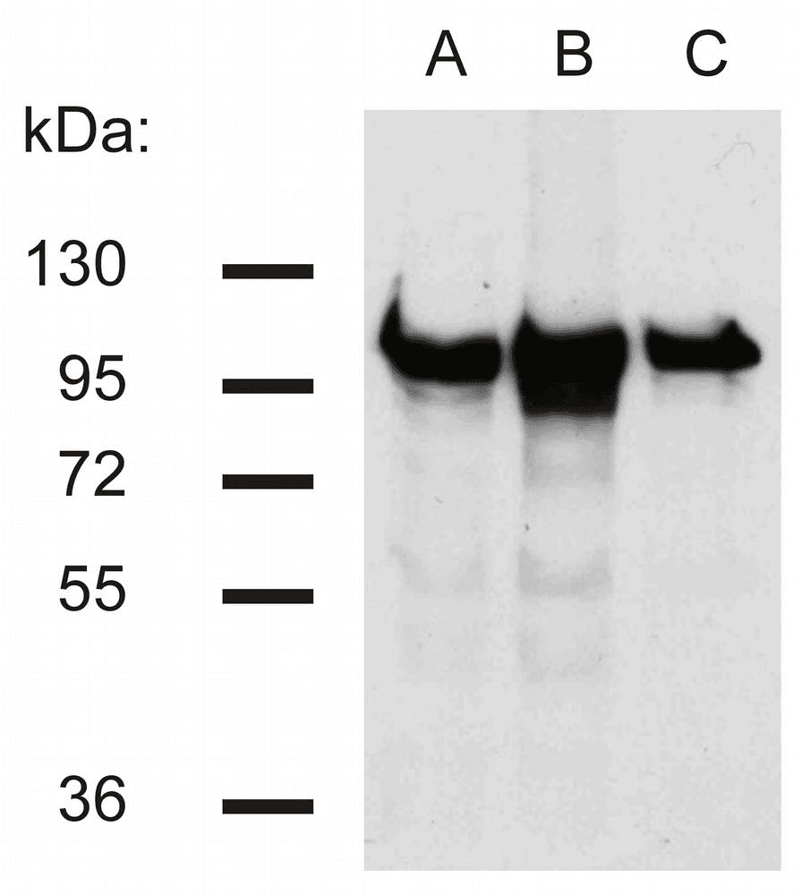 PathPlus™ CTNNB1 / Beta Catenin Antibody (clone EM-22)