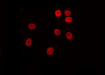 Polyclonal Rabbit anti-Human RAD51B Antibody (IHC, IF, WB)