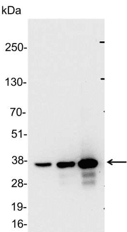 Polyclonal Rabbit anti-Schistosoma japonicum GST / Glutathione S-Transferase Antibody (WB)