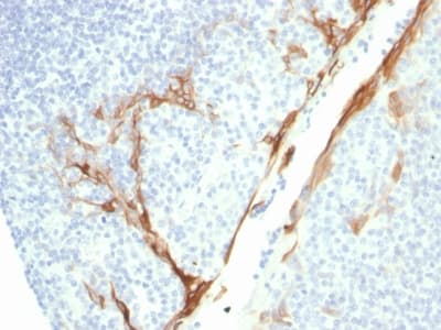 PathPlus™ KRT16 / CK16 / Cytokeratin 16 Antibody (C-Terminus, clone rKRT16/1714)