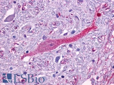 PathPlus™ ADGRE3 / EMR3 Antibody (N-Terminus)