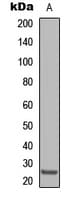 Polyclonal Rabbit anti-Human CLDN8 / Claudin 8 Antibody (Internal, WB)
