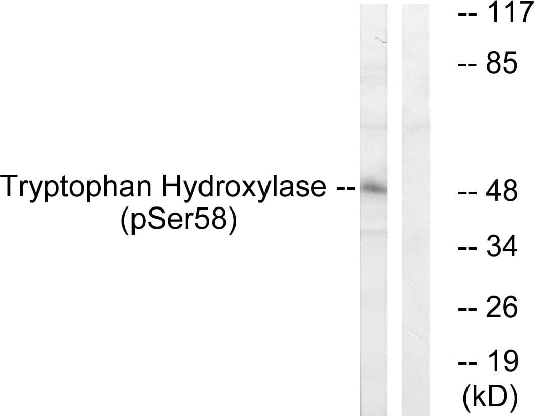 Polyclonal Rabbit anti-Human TPH1 / Tryptophan Hydroxylase Antibody (phospho-Ser58, IHC, WB)