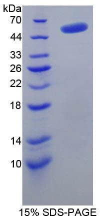 Rat TP / Thymidine Phosphorylase Protein (Recombinant His-GST)