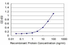 IHC-plus™ Monoclonal Mouse anti-Human EN1 / Engrailed Antibody (clone 1F5, IHC, WB)