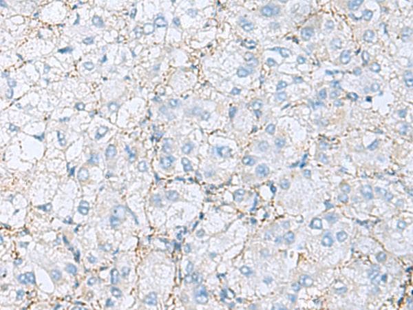 EMILIN1 / EMI Antibody