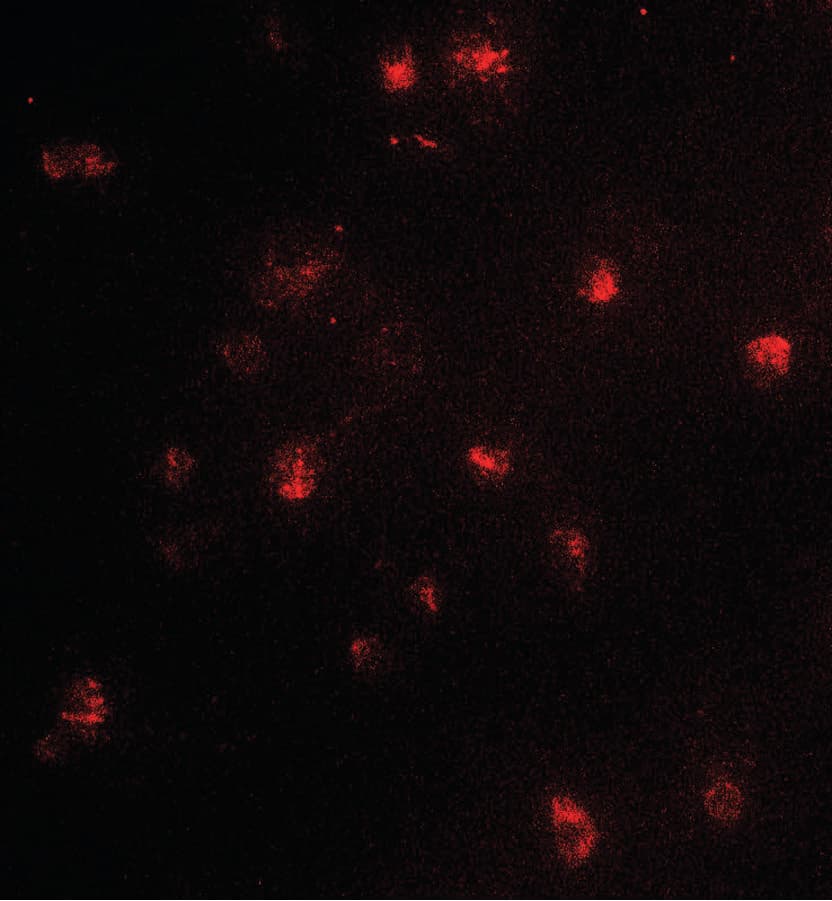 IHC-plus™ PRMT4 / CARM1 Antibody