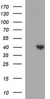 SERPINB3 Antibody (clone OTI1C10)