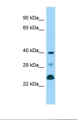 Polyclonal Rabbit anti-Mouse DUSP11 Antibody (aa51-100, WB)