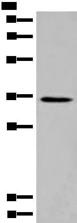 ABRI / ITM2B Antibody