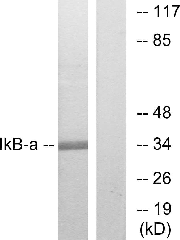 IHC-plus™ Polyclonal Rabbit anti-Human NFKBIA / IKB Alpha / IKBA Antibody (aa15-64, IHC, WB)
