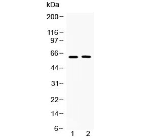 Polyclonal Rabbit anti-Human TUB / Tubby Antibody (WB)