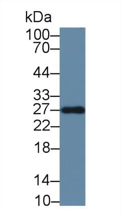 IGHG1 / IgG Antibody (Biotin)