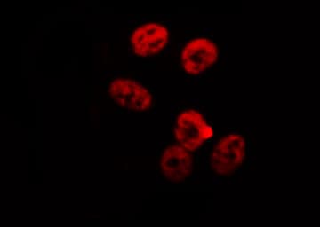 Polyclonal Rabbit anti-Human RBMX Antibody (IHC, IF, WB)