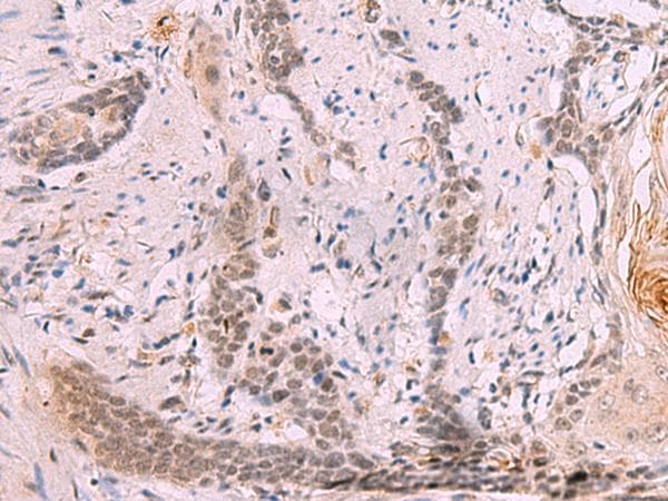 Polyclonal Rabbit anti-Human INO80 Antibody (IHC)