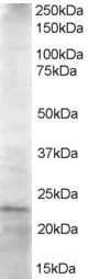 IHC-plus™ Polyclonal Goat anti-Human UBE2K / LIG Antibody (aa144-157, IHC, WB)