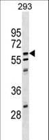 CPNE5 Antibody (aa509-535)