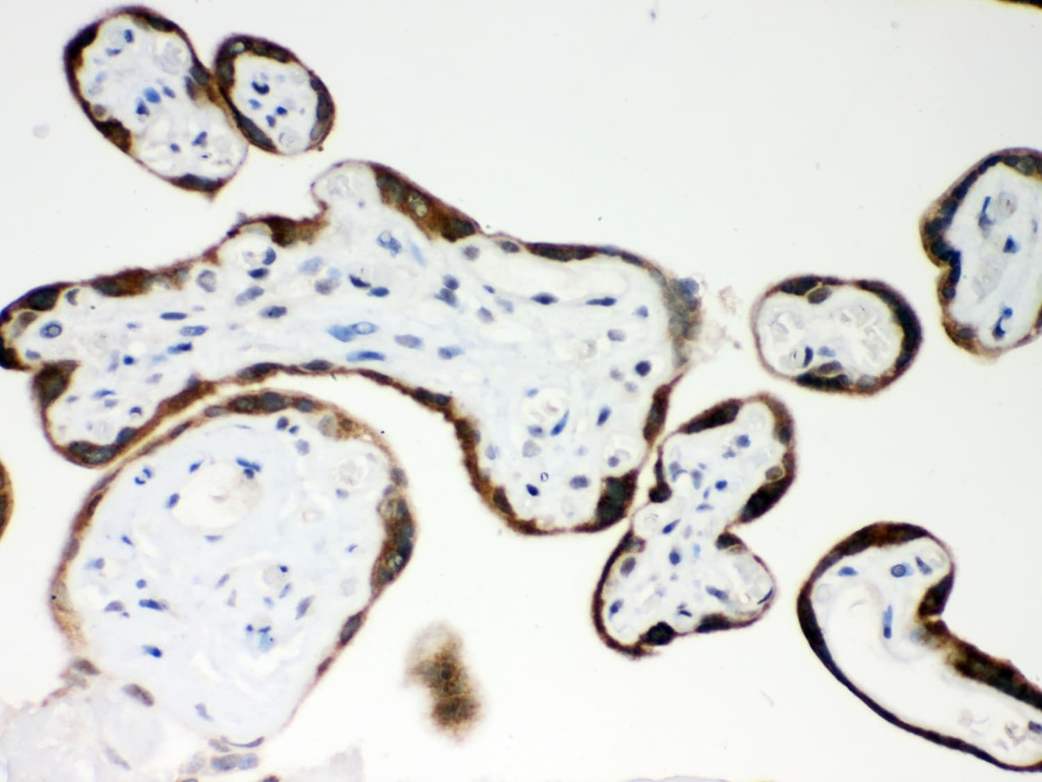 PAPPA / PAPP-A Antibody (aa95-388)