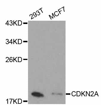 Polyclonal Rabbit anti-Human p16INK4a / CDKN2A Antibody (IHC, IF, WB)