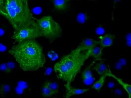 TNNI3 / Cardiac Troponin I Antibody (clone OTI4E5)