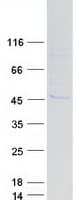 Human ARMCX3 Protein (Recombinant Myc-DDK (Flag))