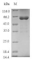 Human STX11 / Syntaxin 11 Protein (Recombinant GST, N-terminus)