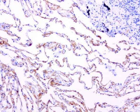 Adiponectin Antibody (aa19-244, clone UMAB104)