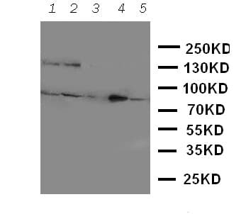 NTRK3 / TRKC Antibody (aa172-186)