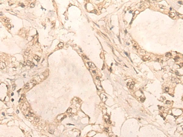 PLEKHA1 Antibody