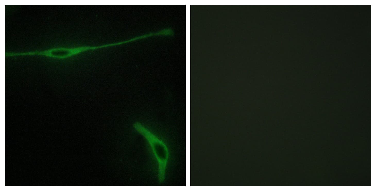 Polyclonal Rabbit anti-Human LAMA2 / Merosin Antibody (aa2011-2060, IHC, IF)