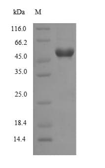 Human WNT7B Protein (Recombinant 10His-SUMO, N-terminus + Myc, C-terminus)