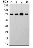 Polyclonal Rabbit anti-Human RPS6KB1 / P70S6K / S6K Antibody (C-Terminus, IHC, WB)