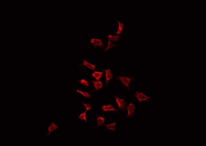 MAP3K3 / MEKK3 Antibody