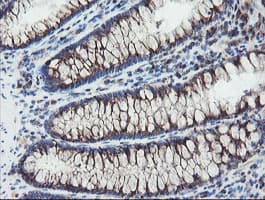 GCP60 / ACBD3 Antibody (clone OTI5F9)