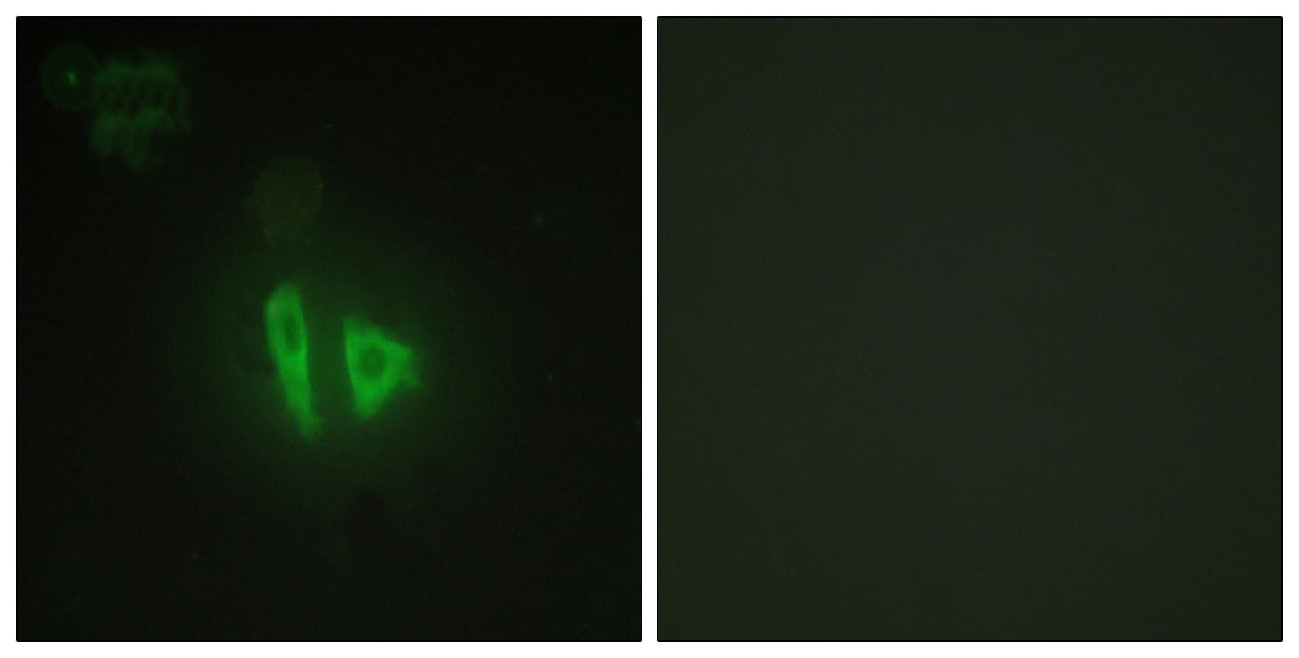 Polyclonal Rabbit anti-Human AKAP11 / KIAA0629 Antibody (aa1761-1810, IHC, IF)