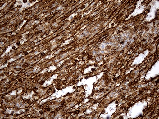 Monoclonal Mouse anti-Human IFITM2 Antibody (clone OTI2B3, Carrier-free, IHC, WB)