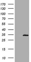 ABCB1 / MDR1 / P Glycoprotein Antibody (clone OTI4F3)