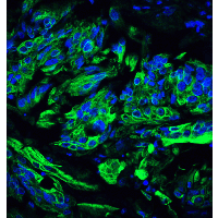 TET2 Antibody