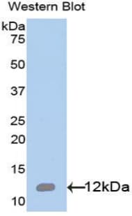 IL8 / Interleukin 8 Antibody (aa28-99, Cy3)