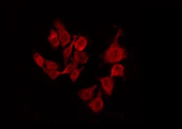 SREBF1 / SREBP-1 Antibody (phospho-Ser439)