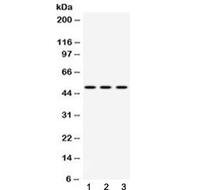 TNFRSF10A / DR4 Antibody