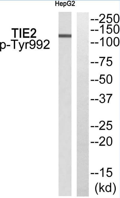 Polyclonal Rabbit anti-Human TEK / TIE2 Antibody (phospho-Tyr992, WB)