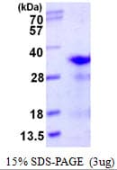 Human RPL8 / Ribosomal Protein L8 (Recombinant His)