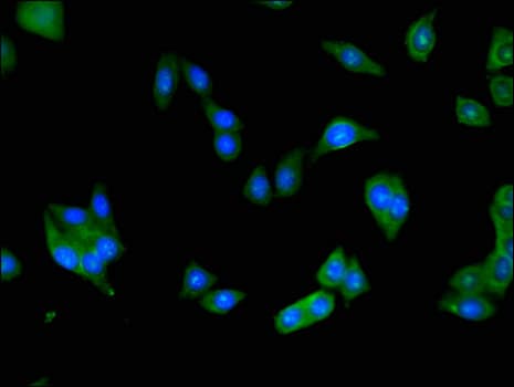 Polyclonal Rabbit anti-Human BAAT / BAT Antibody (IHC, IF)