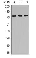 HSPA6 / HSP70B' Antibody