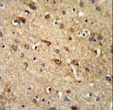 RGR Antibody (aa265-291)
