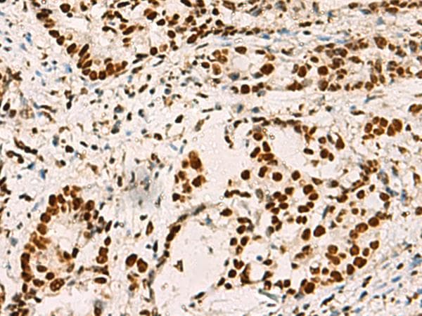 ELF5 Antibody
